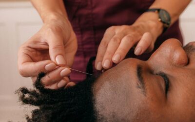 How Acupuncture Helps Relieve Headaches: A Traditional and Modern Perspective